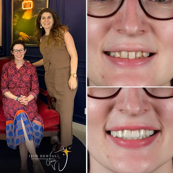 Before and After Treatment 1