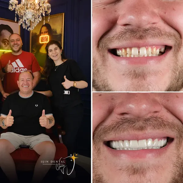 Before and After Treatment 2