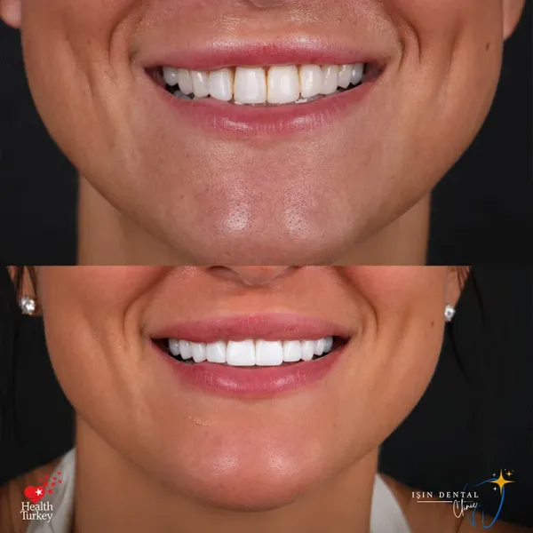 Before and After Treatment 8